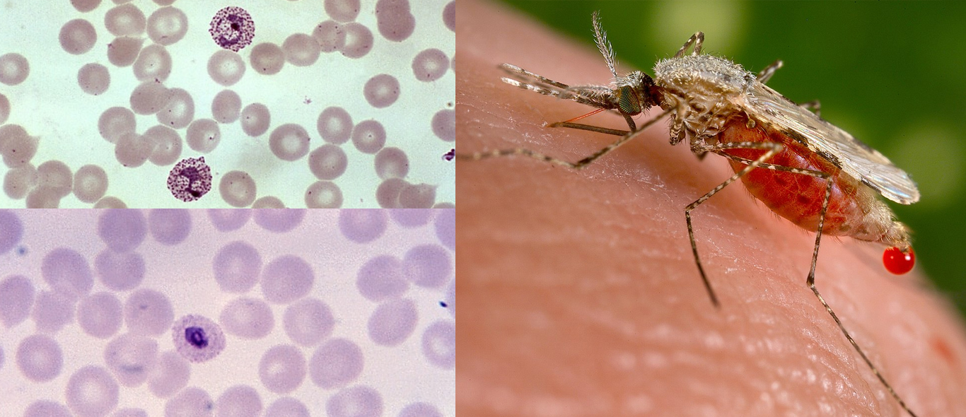 2025年度マヒドン大学熱帯医学短期研修